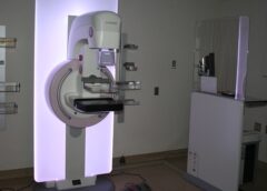 Zdravlje nema cenu „Mamografija – pregled koji može da vam spasi život“